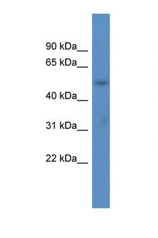 ACOT9 Antibody - ACOT9 antibody Western blot of Fetal Lung lysate. Antibody concentration 1 ug/ml.  This image was taken for the unconjugated form of this product. Other forms have not been tested.