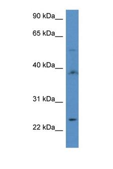 ACOT9 Antibody - ACOT9 antibody Western blot of 435S Cell lysate. Antibody concentration 1 ug/ml.  This image was taken for the unconjugated form of this product. Other forms have not been tested.