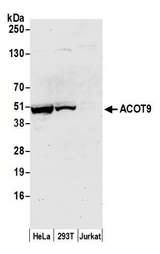 ACOT9 Antibody - Detection of human ACOT9 by western blot. Samples: Whole cell lysate (50 µg) from HeLa, HEK293T, and Jurkat cells prepared using NETN lysis buffer. Antibody: Affinity purified rabbit anti-ACOT9 antibody used for WB at 1:1000. Detection: Chemiluminescence with an exposure time of 30 seconds.