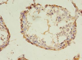 ACOT9 Antibody - Immunohistochemistry of paraffin-embedded human testis tissue using antibody at 1:100 dilution.  This image was taken for the unconjugated form of this product. Other forms have not been tested.