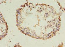 ACOT9 Antibody - Immunohistochemistry of paraffin-embedded human testis tissue using antibody at 1:100 dilution.  This image was taken for the unconjugated form of this product. Other forms have not been tested.