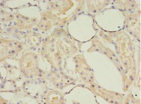 ACOT9 Antibody - Immunohistochemistry of paraffin-embedded human kidney tissue using antibody at 1:100 dilution.  This image was taken for the unconjugated form of this product. Other forms have not been tested.