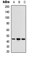 ACOT9 Antibody - Western blot analysis of ACOT9 expression in HEK293T (A); Raw264.7 (B); H9C2 (C) whole cell lysates.
