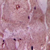 ACOT9 Antibody - Immunohistochemical analysis of ACOT9 staining in human heart formalin fixed paraffin embedded tissue section. The section was pre-treated using heat mediated antigen retrieval with sodium citrate buffer (pH 6.0). The section was then incubated with the antibody at room temperature and detected using an HRP conjugated compact polymer system. DAB was used as the chromogen. The section was then counterstained with hematoxylin and mounted with DPX. w