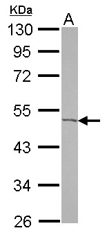 ACOT9 Antibody - Sample (30 ug of whole cell lysate) A: U87-MG 10% SDS PAGE ACOT9 antibody diluted at 1:500