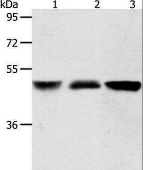 ACOT9 Antibody - Western blot analysis of Human brain malignant glioma and human fetal kidney tissue, A172 cell, using ACOT9 Polyclonal Antibody at dilution of 1:600.