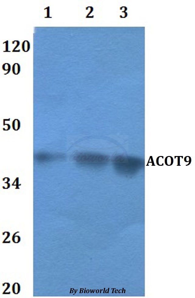 ACOT9 Antibody - Western blot of ACOT9 antibody at 1:500 dilution. Lane 1: HEK293T whole cell lysate. Lane 2: RAW264.7 whole cell lysate.