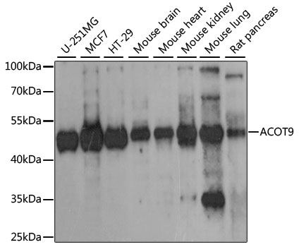 ACOT9 Antibody - Western blot analysis of extracts of various cell lines, using ACOT9 antibody at 1:1000 dilution. The secondary antibody used was an HRP Goat Anti-Rabbit IgG (H+L) at 1:10000 dilution. Lysates were loaded 25ug per lane and 3% nonfat dry milk in TBST was used for blocking. An ECL Kit was used for detection and the exposure time was 30s.