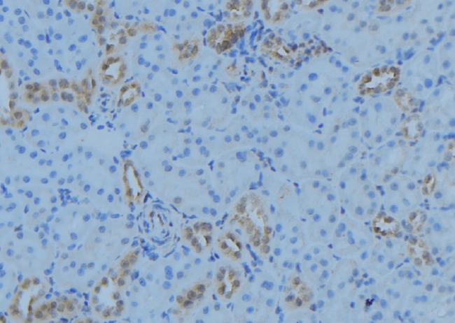 ACOT9 Antibody - 1:100 staining mouse kidney tissue by IHC-P. The sample was formaldehyde fixed and a heat mediated antigen retrieval step in citrate buffer was performed. The sample was then blocked and incubated with the antibody for 1.5 hours at 22°C. An HRP conjugated goat anti-rabbit antibody was used as the secondary.