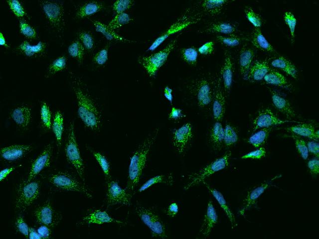 ACOT9 Antibody - Immunofluorescence staining of ACOT9 in U251MG cells. Cells were fixed with 4% PFA, permeabilzed with 0.1% Triton X-100 in PBS, blocked with 10% serum, and incubated with rabbit anti-Human ACOT9 polyclonal antibody (dilution ratio 1:200) at 4°C overnight. Then cells were stained with the Alexa Fluor 488-conjugated Goat Anti-rabbit IgG secondary antibody (green) and counterstained with DAPI (blue). Positive staining was localized to Nucleus and Cytoplasm.