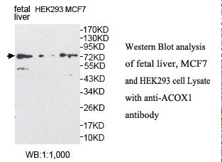 ACOX1 / ACOX Antibody