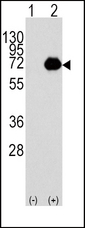 ACOX1 / ACOX Antibody - Western blot of ACOX1 (arrow) using rabbit polyclonal ACOX1 Antibody (RB04651). 293 cell lysates (2 ug/lane) either nontransfected (Lane 1) or transiently transfected with the ACOX1 gene (Lane 2) (Origene Technologies).