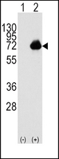 ACOX1 / ACOX Antibody - Western blot of ACOX1 (arrow) using rabbit polyclonal ACOX1 Antibody (RB04652). 293 cell lysates (2 ug/lane) either nontransfected (Lane 1) or transiently transfected with the ACOX1 gene (Lane 2) (Origene Technologies).