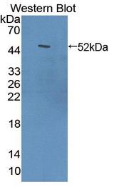 ACOX1 / ACOX Antibody - Western Blot; Sample: Recombinant protein.
