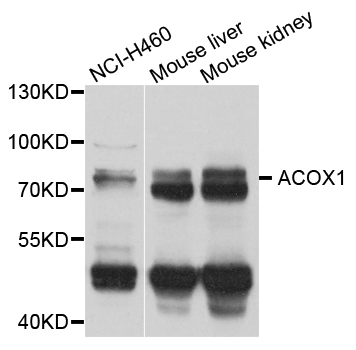 ACOX1 / ACOX Antibody - Western blot analysis of extract of various cells.