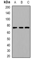 ACOX1 / ACOX Antibody - Western blot analysis of ACOX1 expression in NCIH460 (A); mouse liver (B); mouse kidney (C) whole cell lysates.