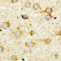 ACOX1 / ACOX Antibody - Immunohistochemical analysis of ACOX1 staining in mouse brain formalin fixed paraffin embedded tissue section. The section was pre-treated using heat mediated antigen retrieval with sodium citrate buffer (pH 6.0). The section was then incubated with the antibody at room temperature and detected using an HRP conjugated compact polymer system. DAB was used as the chromogen. The section was then counterstained with hematoxylin and mounted with DPX.