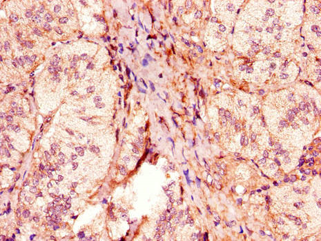 ACOX1 / ACOX Antibody - Immunohistochemistry of paraffin-embedded human adrenal gland tissue using ACOX1 Antibody at dilution of 1:100