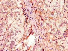 ACOX1 / ACOX Antibody - Immunohistochemistry of paraffin-embedded human adrenal gland tissue using ACOX1 Antibody at dilution of 1:100