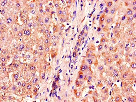 ACOX1 / ACOX Antibody - Immunohistochemistry of paraffin-embedded human liver tissue using ACOX1 Antibody at dilution of 1:100