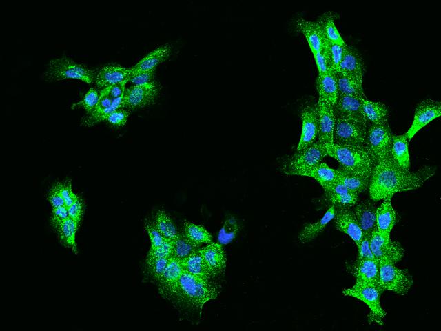 ACOX1 / ACOX Antibody - Immunofluorescence staining of ACOX1 in A431 cells. Cells were fixed with 4% PFA, permeabilzed with 0.1% Triton X-100 in PBS, blocked with 10% serum, and incubated with rabbit anti-Human ACOX1 polyclonal antibody (dilution ratio 1:200) at 4°C overnight. Then cells were stained with the Alexa Fluor 488-conjugated Goat Anti-rabbit IgG secondary antibody (green) and counterstained with DAPI (blue). Positive staining was localized to Cytoplasm.
