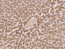ACOX1 / ACOX Antibody - Immunochemical staining of human ACOX1 in human liver with rabbit polyclonal antibody at 1:100 dilution, formalin-fixed paraffin embedded sections.