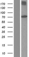 ACOX1 / ACOX Protein - Western validation with an anti-DDK antibody * L: Control HEK293 lysate R: Over-expression lysate