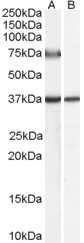 ACOX2 Antibody - Antibody (0.5 ug/ml) staining of Human Liver lysate (35 ug protein in RIPA buffer) with (B) and without (A) blocking with the immunizing peptide. Primary incubation was 1 hour. Detected by chemiluminescence.