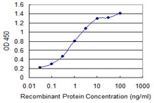 ACOX2 Antibody - Detection limit for recombinant GST tagged ACOX2 is 0.03 ng/ml as a capture antibody.
