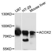 ACOX2 Antibody - Western blot analysis of extracts of various cell lines, using ACOX2 antibody at 1:3000 dilution. The secondary antibody used was an HRP Goat Anti-Rabbit IgG (H+L) at 1:10000 dilution. Lysates were loaded 25ug per lane and 3% nonfat dry milk in TBST was used for blocking. An ECL Kit was used for detection and the exposure time was 30s.