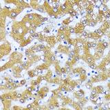 ACOX2 Antibody - Immunohistochemistry of paraffin-embedded Human liver using ACOX2 Polyclonal Antibody at dilution of 1:100 (40x lens).