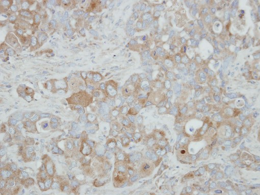 ACOX3 Antibody - IHC of paraffin-embedded H441 xenograft using ACOX3 antibody at 1:500 dilution.