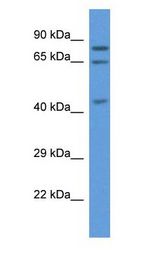 ACOX3 Antibody - ACOX3 antibody Western Blot of 721_B.  This image was taken for the unconjugated form of this product. Other forms have not been tested.