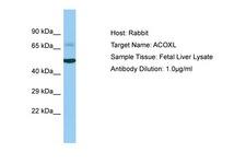 ACOXL Antibody -  This image was taken for the unconjugated form of this product. Other forms have not been tested.