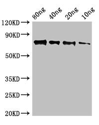 ACP 9, SAP9 Antibody - Western Blot Positive WB detected in Recombinant protein All Lanes:SAP9 antibody at 2.5µg/ml Secondary Goat polyclonal to rabbit IgG at 1/50000 dilution Predicted band size: 75 kDa Observed band size: 75 kDa
