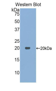 ACP1 / Acid Phosphatase Antibody - Western blot of recombinant ACP1 / Acid Phosphatase.  This image was taken for the unconjugated form of this product. Other forms have not been tested.