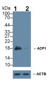 ACP1 / Acid Phosphatase Antibody - Knockout Varification: Lane 1: Wild-type Hela cell lysate; Lane 2: ACP1 knockout Hela cell lysate; Predicted MW: 18kDa Observed MW: 17kDa Primary Ab: 1µg/ml Rabbit Anti-Rat ACP1 Antibody Second Ab: 0.2µg/mL HRP-Linked Caprine Anti-Rabbit IgG Polyclonal Antibody