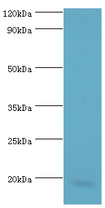ACP1 / Acid Phosphatase Antibody - Western blot. All lanes: Low molecular weight phosphotyrosine protein phosphatase antibody at 4 ug/ml+HepG2 whole cell lysate. Secondary antibody: Goat polyclonal to rabbit at 1:10000 dilution. Predicted band size: 18 kDa. Observed band size: 18 kDa.