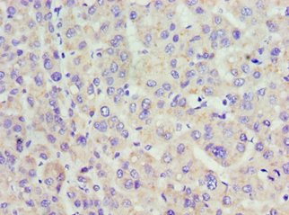 ACP1 / Acid Phosphatase Antibody - Immunohistochemistry of paraffin-embedded human placenta using antibody at 1:100 dilution.