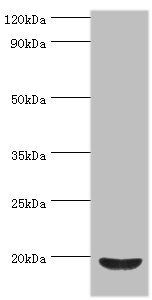 ACP1 / Acid Phosphatase Antibody - Western blot All lanes: Low molecular weight phosphotyrosine protein phosphatase antibody at 4µg/ml + HepG2 whole cell lysate Secondary Goat polyclonal to rabbit IgG at 1/10000 dilution Predicted band size: 19, 18, 15, 13 kDa Observed band size: 19 kDa