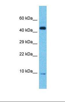 ACP1 / Acid Phosphatase Antibody - Western blot of Human Pancreas Tumor. ACP1 antibody dilution 1.0 ug/ml.  This image was taken for the unconjugated form of this product. Other forms have not been tested.
