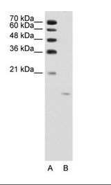 ACP1 / Acid Phosphatase Antibody - A: Marker, B: Jurkat Cell Lysate.  This image was taken for the unconjugated form of this product. Other forms have not been tested.