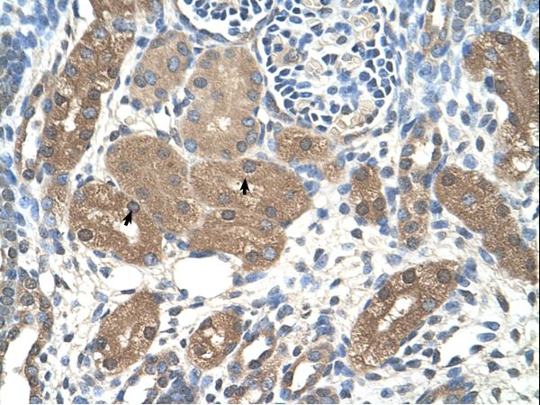ACP1 / Acid Phosphatase Antibody - ACP1 / Acid Phosphatase antibody ARP42178_T100-NP_004291-ACP1(acid phosphatase 1, soluble) Antibody was used in IHC to stain formalin-fixed, paraffin-embedded human kidney.  This image was taken for the unconjugated form of this product. Other forms have not been tested.