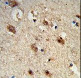 ACP1 / Acid Phosphatase Antibody - Formalin-fixed and paraffin-embedded human brain tissue reacted with ACP1 Antibody , which was peroxidase-conjugated to the secondary antibody, followed by DAB staining. This data demonstrates the use of this antibody for immunohistochemistry; clinical relevance has not been evaluated.