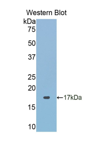 ACP1 / Acid Phosphatase Antibody - Western blot of ACP1 / Acid Phosphatase antibody.