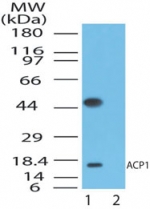 ACP1 / Acid Phosphatase Antibody - Western blot of ACP1 in the 1) absence and 2) presence of immunizing peptide in human liver lysate using antibody at 1 ug/ml.