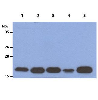 ACP1 / Acid Phosphatase Antibody - The Cell lysates (40ug) were resolved by SDS-PAGE, transferred to PVDF membrane and probed with anti-human ACP1 antibody (1:1000). Proteins were visualized using a goat anti-mouse secondary antibody conjugated to HRP and an ECL detection system. Lane 1. : HeLa cell lysate Lane 2. : Jurkat cell lysate Lane 3. : TF-1 cell lysate Lane 4. : NIH/3T3 cell lysate Lane 5. : HepG2 cell lysate