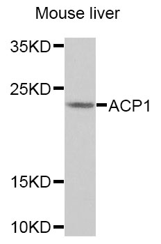 ACP1 / Acid Phosphatase Antibody - Western blot analysis of extracts of Mouse liver cells.