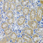 ACP1 / Acid Phosphatase Antibody - Immunohistochemistry of paraffin-embedded mouse kidney using ACP1 antibody at dilution of 1:100 (40x lens).