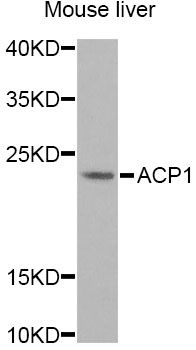 ACP1 / Acid Phosphatase Antibody - Western blot analysis of extracts of mouse liver, using ACP1 Antibody at 1:1000 dilution. The secondary antibody used was an HRP Goat Anti-Rabbit IgG (H+L) at 1:10000 dilution. Lysates were loaded 25ug per lane and 3% nonfat dry milk in TBST was used for blocking.